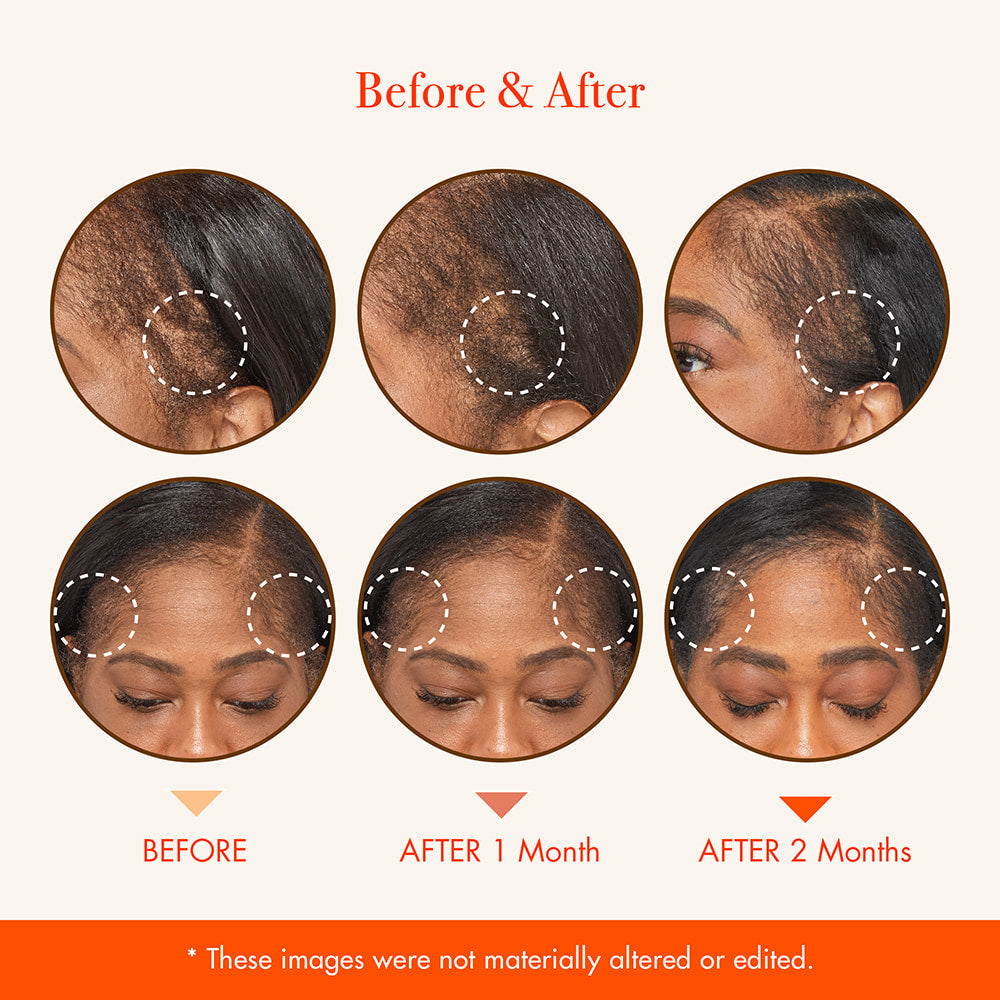 Growth MD Scalp Ampoule .4 OZ - ANNS BEAUTY SUPPLY