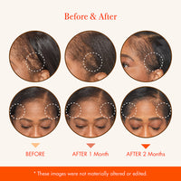 Growth MD Scalp Ampoule .4 OZ - ANNS BEAUTY SUPPLY