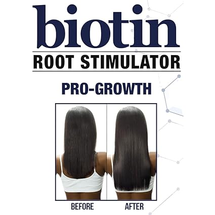 Difeel Biotin Leave-In Root Stimulator 7.1oz - ANNS BEAUTY SUPPLY