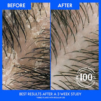 Head & Shoulders Tea Tree Oil 2 In 1 Dandruff Shampoo + Conditioner 12.5 FL OZ (370 mL)