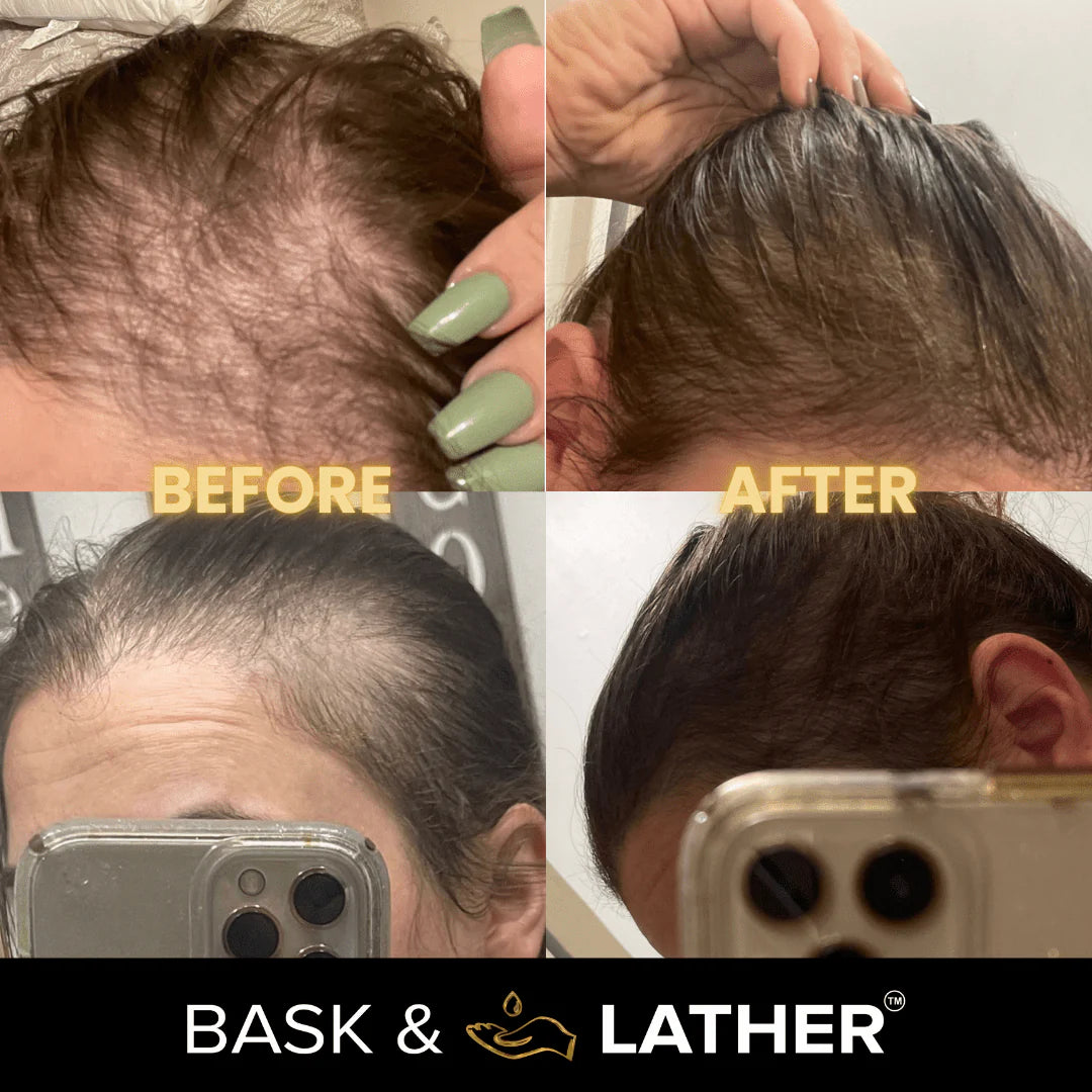 Bask & Lather Scalp Stimulator Hair Growth Oil 2 Fl. Oz. (59 ml)